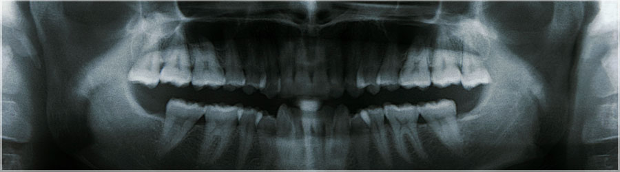 Dentition, ne faites pas attention au cerveau ! Dentition, ne regardez pas le znith ! www.360x180.fr Selme Matthieu